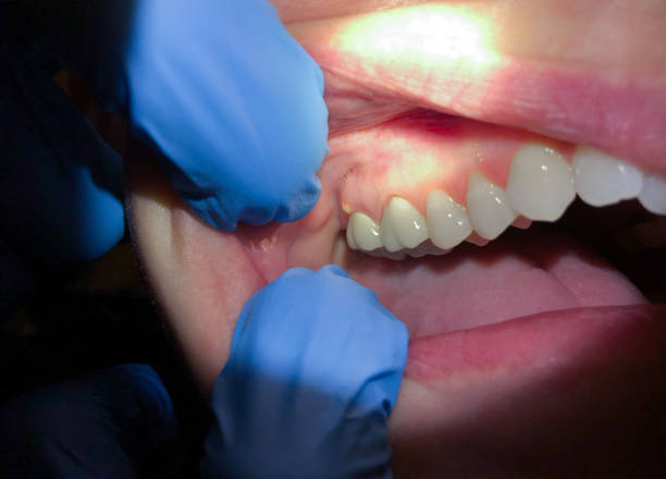 Best Same-Day Emergency Dentist in East Flat Rock, NC