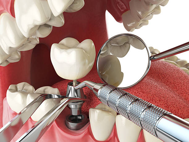Best Emergency Treatment for Toothache in East Flat Rock, NC